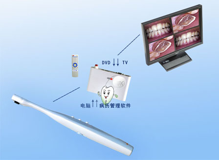 四画面口腔内窥镜